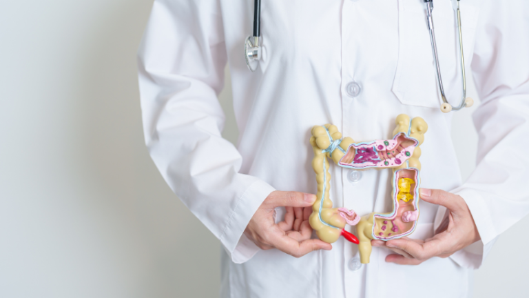 Câncer de intestino: quando iniciar o rastreio e quais exames garantem diagnóstico precoce Câncer de intestino: quando iniciar o rastreio e quais exames garantem diagnóstico precoce